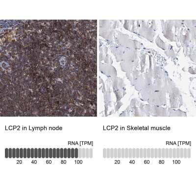 <b>Orthogonal Strategies Validation. </b>Immunohistochemistry-Paraffin: SLP-76/LCP2 Antibody [NBP1-87032] - Staining in human lymph node and skeletal muscle tissues using anti-LCP2 antibody. Corresponding LCP2 RNA-seq data are presented for the same tissues.