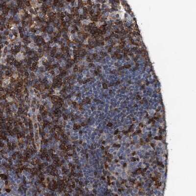 Immunohistochemistry-Paraffin: SLP-76/LCP2 Antibody [NBP1-87033] - Staining of human lymph node shows high expression.