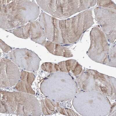 Immunohistochemistry-Paraffin: SLP-76/LCP2 Antibody [NBP1-87033] - Staining of human skeletal muscle shows low expression as expected.