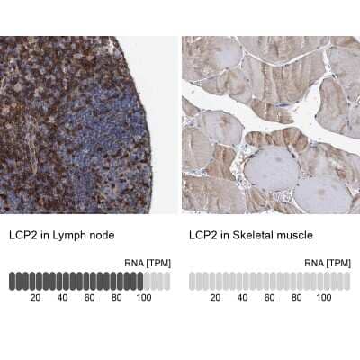 <b>Orthogonal Strategies Validation. </b>Immunohistochemistry-Paraffin: SLP-76/LCP2 Antibody [NBP1-87033] - Staining in human lymph node and skeletal muscle tissues using anti-LCP2 antibody. Corresponding LCP2 RNA-seq data are presented for the same tissues.