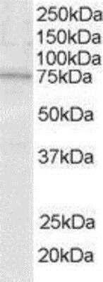 Western Blot: SLP-76/LCP2 Antibody [NB100-1439] - (0.5ug/ml) of Jurkat lysate (RIPA buffer, 35ug total protein per lane). Primary incubated for 1 hour. Detected by western blot using chemiluminescence.