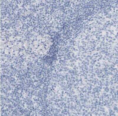 Immunohistochemistry-Paraffin: SLPI Antibody [NBP1-89139] - Staining of human lymph node shows no positivity in myocytes as expected.