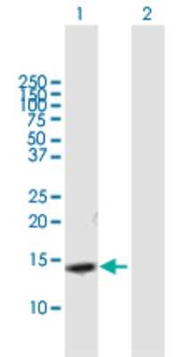 Western Blot: SLPI Antibody [H00006590-B01P] - Analysis of SLPI expression in transfected 293T cell line by SLPI polyclonal antibody.  Lane 1: SLPI transfected lysate(14.52 KDa). Lane 2: Non-transfected lysate.