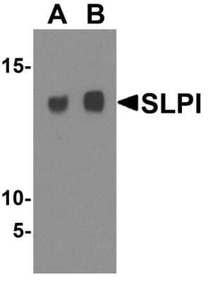 Western Blot: SLPI Antibody [NBP1-76396] - Analysis in A-20 cell lysate with antibody at (A) 1 and (B) 2 ug/mL.