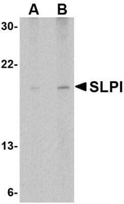 Western Blot: SLPI Antibody [NBP1-76803] - Daudi cell lysate with SLPI antibody at (A) 1 and (B) 2 ug/mL.