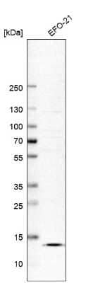 <b>Orthogonal Strategies Validation. </b>Western Blot: SLPI Antibody [NBP1-89139] - Analysis in human cell line EFO-21.