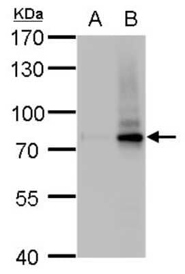 Western Blot: SLU7 Antibody (262) [NBP2-43793] - Analysis of A. 30 ug 293T whole cell lysate/extract B. 30 ug whole cell lysate/extract of human SLU7-transfected 293T cells 7.5 % SDS-PAGE SLU7 antibody [262] dilution: 1:10000.