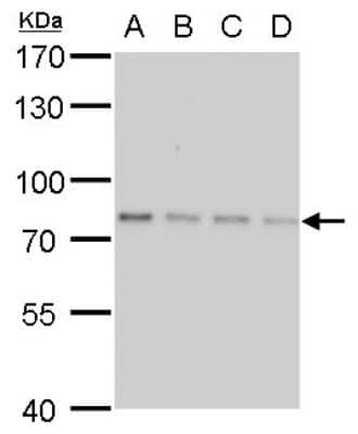 Western Blot: SLU7 Antibody (759) [NBP2-43794] - Analysis of A. 30 ug 293T whole cell lysate/extract B. 30 ug A431 whole cell lysate/extract C. 30 ug HeLa whole cell lysate/extract D. 30 ug HepG2 whole cell lysate/extract 7.5 % SDS-PAGE SLU7 antibody [759] dilution: 1:1000