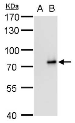 Western Blot: SLU7 Antibody (759) [NBP2-43794] - Analysis of A. 30 ug 293T whole cell lysate/extract B. 30 ug whole cell lysate/extract of human SLU7-transfected 293T cells 7.5 % SDS-PAGE SLU7 antibody [759] dilution: 1:5000.