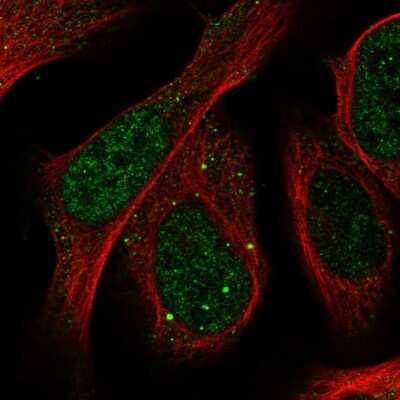 Immunocytochemistry/Immunofluorescence: SLU7 Antibody [NBP1-89343] - Immunofluorescent staining of human cell line U-2 OS shows localization to nucleoplasm & vesicles.