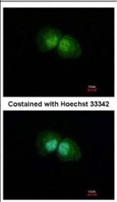 Immunocytochemistry/Immunofluorescence: SLU7 Antibody [NBP2-20402] - Immunofluorescence analysis of paraformaldehyde-fixed A431, using antibody at 1:500 dilution.