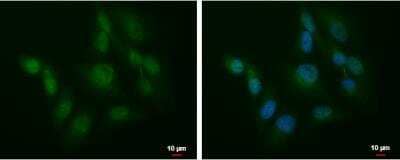 Immunocytochemistry/Immunofluorescence: SLU7 Antibody [NBP2-20402] -  HeLa cells were fixed in 4% paraformaldehyde at RT for 15 min. Green: SLU7 protein stained by SLU7 antibody  diluted at 1:1000. Blue: Hoechst 33342 staining. Scale bar = 10 um.