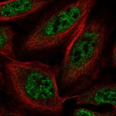 Immunocytochemistry/Immunofluorescence: SLU7 Antibody [NBP2-58665] - Staining of human cell line U-2 OS shows localization to nuclear speckles.