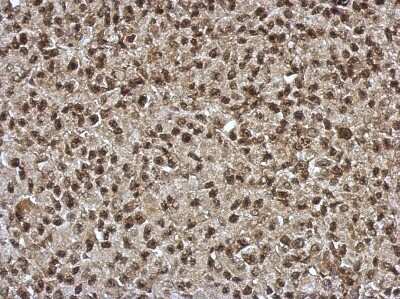 Immunohistochemistry-Paraffin: SLU7 Antibody [NBP2-20403] - HBL435 xenograft, using SLU7 antibody at 1:500 dilution. Antigen Retrieval: Trilogy™ (EDTA based, pH 8.0) buffer, 15min.