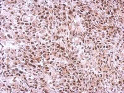 Immunohistochemistry-Paraffin: SLU7 Antibody [NBP2-42921] - Analysis of Ca922 xenograft, using avian Slu7 antibody antibody at 1:500 dilution.