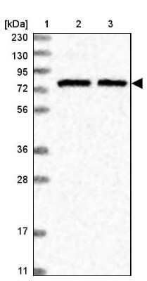 Western Blot: SLU7 Antibody [NBP1-89343] - Lane 1: Marker  [kDa] 230, 130, 95, 72, 56, 36, 28, 17, 11.  Lane 2: Human cell line RT-4.  Lane 3: Human cell line U-251MG sp