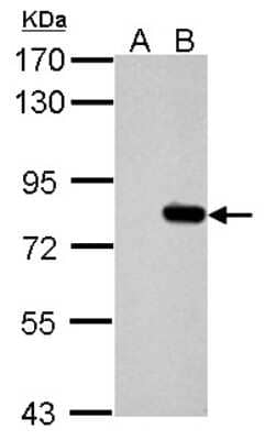 Western Blot: SLU7 Antibody [NBP2-20402] - Sample (30 ug of whole cell lysate) A: Non-transfected 293T lysates B: hSLU7 transfected 293T lysates 7. 5% SDS PAGE gel, diluted at 1:10000.