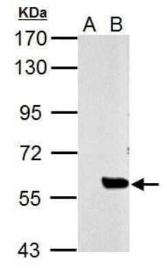 Western Blot: SLU7 Antibody [NBP2-42921] - Analysis of 30 ug whole cell lysate. A: Non-transfected 293T lysates B: Avian slu7 transfected 293T lysates 7.5% SDS PAGE diluted at 1:5000.