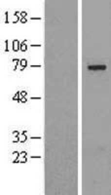 Western Blot: SLU7 Overexpression Lysate (Adult Normal) [NBL1-16216] Left-Empty vector transfected control cell lysate (HEK293 cell lysate); Right -Over-expression Lysate for SLU7.