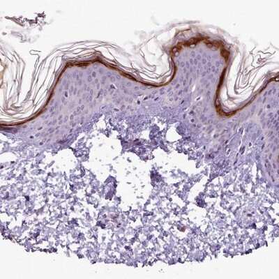 Immunohistochemistry-Paraffin: SLURP1 Antibody [NBP2-13351] - Staining of human skin shows strong cytoplasmic positivity in a subset of keratinocytes.