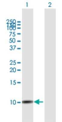 Western Blot: SLURP1 Antibody [H00057152-B01P] - Analysis of SLURP1 expression in transfected 293T cell line by SLURP1 polyclonal antibody.  Lane 1: SLURP1 transfected lysate(11.33 KDa). Lane 2: Non-transfected lysate.