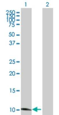 Western Blot: SLURP1 Antibody [H00057152-D01P] - Analysis of SLURP1 expression in transfected 293T cell line by SLURP1 polyclonal antibody.Lane 1: SLURP1 transfected lysate(11.20 KDa).Lane 2: Non-transfected lysate.