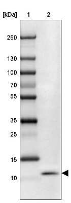 Western Blot: SLURP1 Antibody [NBP2-13351] - Lane 1: Marker  [kDa] 250, 130, 100, 70, 55, 35, 25, 15, 10.  Lane 2: esophagus