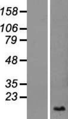 Western Blot: SLURP1 Overexpression Lysate (Adult Normal) [NBP2-06647] Left-Empty vector transfected control cell lysate (HEK293 cell lysate); Right -Over-expression Lysate for SLURP1.