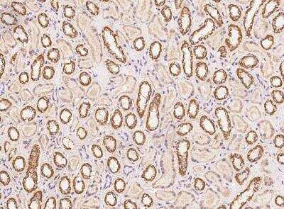 Immunohistochemistry-Paraffin: SLX1A Antibody [NBP3-06545] - Staining of human SLX1A in human kidney with rabbit polyclonal antibody at 1:500 dilution.