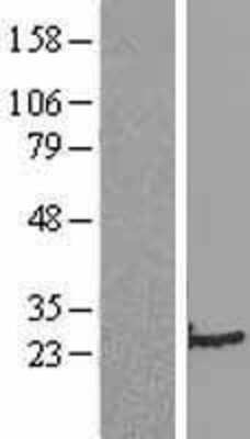 Western Blot Transgelin/TAGLN/SM22 alpha Overexpression Lysate