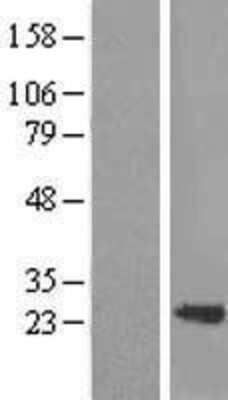 Western Blot Transgelin/TAGLN/SM22 alpha Overexpression Lysate