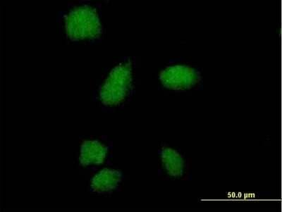 Immunocytochemistry/Immunofluorescence: SMA4 Antibody [H00011039-B01P] - Analysis of purified antibody to SMA4 on HeLa cell. (antibody concentration 10 ug/ml)