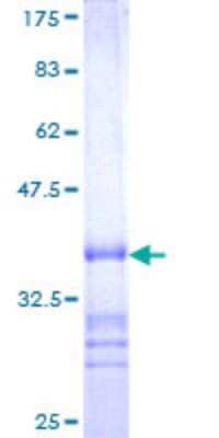 SDS-Page: SMA4 Partial Protein [H00011039-Q01] - 12.5% SDS-PAGE Stained with Coomassie Blue.