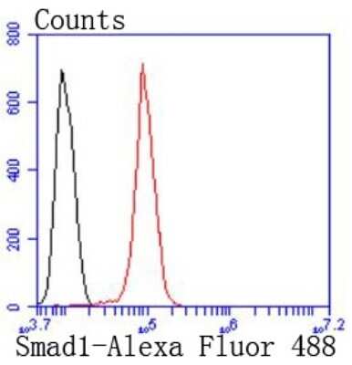 Immunohistochemistry-Paraffin: SMAD1/9 Antibody (SD2090) [NBP2-67768] - Analysis of paraffin-embedded human breast carcinoma tissue using anti-Smad1 antibody. Counter stained with hematoxylin.