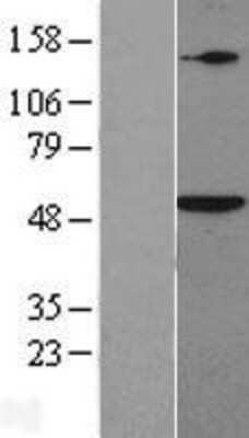 Western Blot: SMAD5 Overexpression Lysate (Adult Normal) [NBP2-08980] Left-Empty vector transfected control cell lysate (HEK293 cell lysate); Right -Over-expression Lysate for SMAD5.