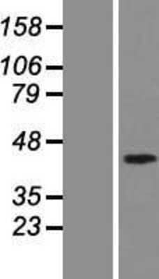 Western Blot: SMAD7 Overexpression Lysate (Adult Normal) [NBP2-07689] Left-Empty vector transfected control cell lysate (HEK293 cell lysate); Right -Over-expression Lysate for SMAD7.