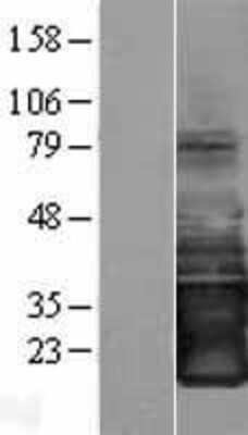 Western Blot: SMAGP Overexpression Lysate (Adult Normal) [NBP2-09191] Left-Empty vector transfected control cell lysate (HEK293 cell lysate); Right -Over-expression Lysate for SMAGP.