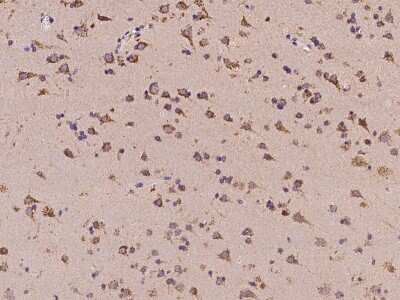 Immunohistochemistry-Paraffin: SMAP Antibody [NBP2-97382] - Immunochemical staining of human SMAP in human brain with rabbit polyclonal antibody at 1:100 dilution, formalin-fixed paraffin embedded sections.