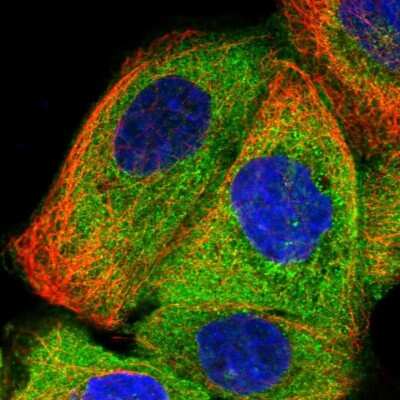 Immunocytochemistry/Immunofluorescence: SMAP1 Antibody [NBP1-83702] - Staining of human cell line A-431 shows positivity in plasma membrane and cytoplasm. Antibody staining is shown in green.