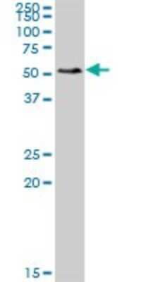 Western Blot: SMAP1 Antibody [H00060682-B01P] - Analysis of SMAP1 expression in HeLa.