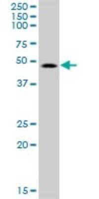 Western Blot SMAP1 Antibody