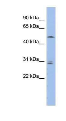 Western Blot: SMAP1 Antibody [NBP1-55453] - OVCAR-3 cell lysate, concentration 0.2-1 ug/ml.