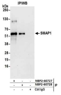 Western Blot: SMAP1 Antibody [NBP2-60728] - Detection of human SMAP1 by western blot of immunoprecipitates. Samples: Whole cell lysate (0.5 or 1.0 mg per IP reaction; 20% of IP loaded) from HeLa cells prepared using NETN lysis buffer. Antibodies: Affinity purified rabbit anti-SMAP1 antibody NBP2-60728 used for IP at 8 ul per reaction. SMAP1 was also immunoprecipitated by rabbit anti-SMAP1 antibody NBP2-60727. For blotting immunoprecipitated SMAP1, NBP2-60728 was used at 1:400. Detection: Chemiluminescence with an exposure time of 3 minutes.