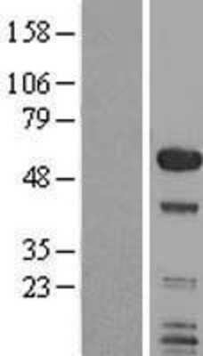 Western Blot SMAP1 Overexpression Lysate