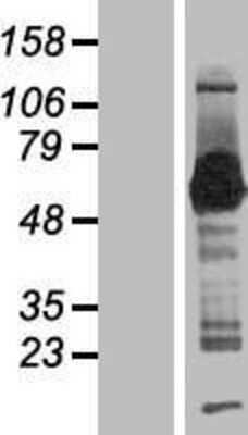 Western Blot SMAP1 Overexpression Lysate