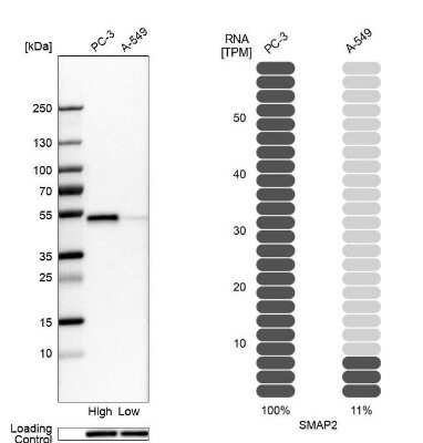 Western Blot SMAP2 Antibody