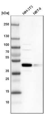 Western Blot SMAP2 Antibody