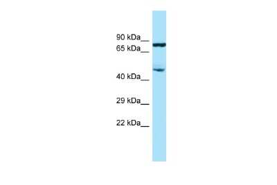 Western Blot: SMAP2 Antibody [NBP2-85774] - WB Suggested Anti-SMAP2 Antibody. Titration: 1.0 ug/ml. Positive Control: THP-1 Whole Cell
