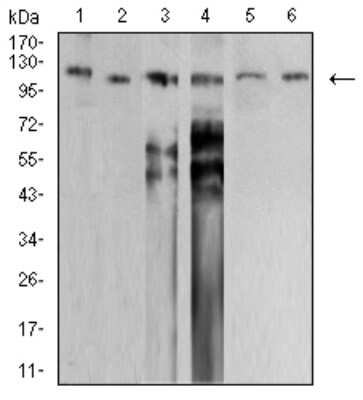 Western Blot: SMARCA1 Antibody (2H7B9) [NBP2-61882] - Analysis using SMARCA1 mouse mAb against PANC-1 (1), HEK293 (2), SW620 (3), HT-29 (4), SH-SY5Y (5), and SK-OV-3 (6) cell lysate.