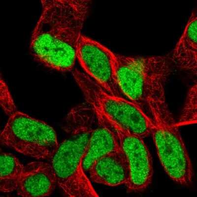 Immunocytochemistry/Immunofluorescence: SMARCA1 Antibody [NBP2-56279] - Staining of human cell line SH-SY5Y shows localization to nucleoplasm.